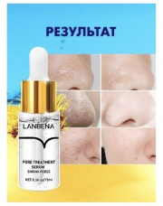 Сыворотка