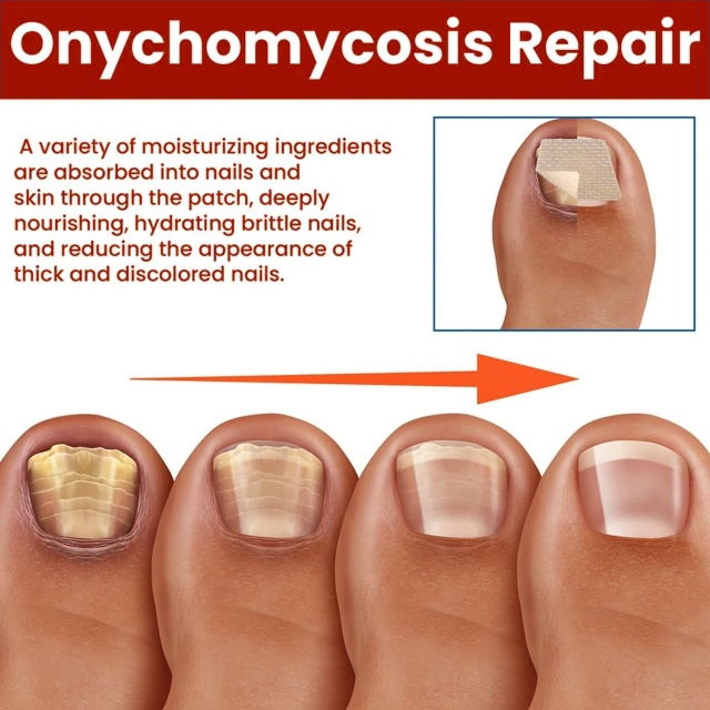 Ночные пластыри для ухода за ногтями 23087338