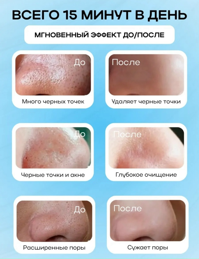 Комплект 23117213